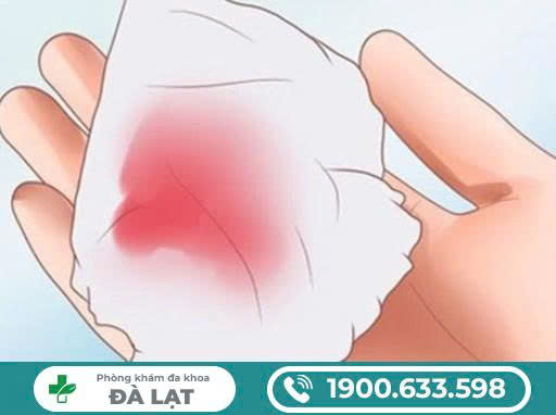 Hình ảnh minh họa